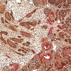 sars-cov-2 gene expression in a human fetus